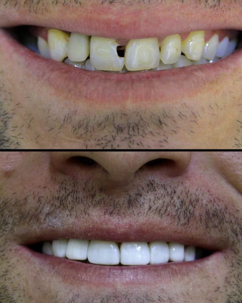 resultados-clinicos-3